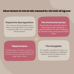 is addiction a brain disease